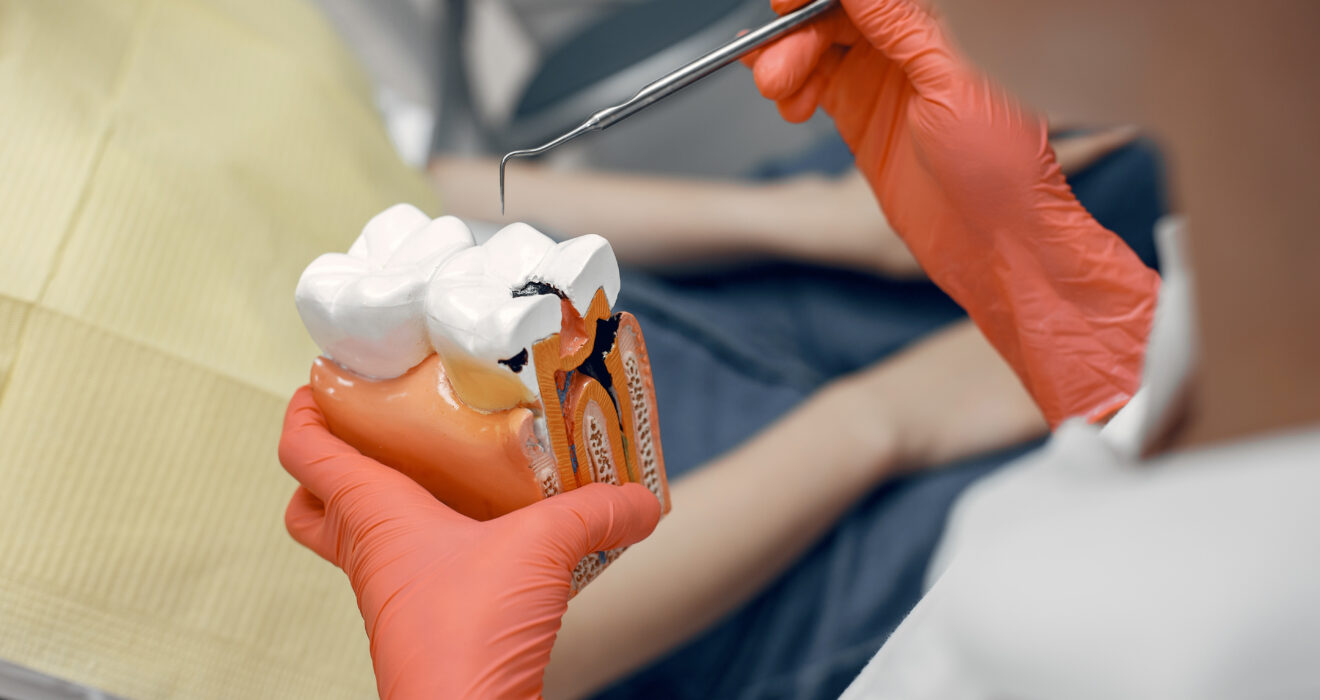 modello-di-un-dente-dal-dentista-il-medico-mostra-al-paziente-un-dente-ricezione-nell-ufficio-del-dentista-scaled.jpg